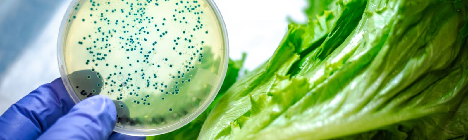 Listeria: ¿qué es y cuáles son sus síntomas?