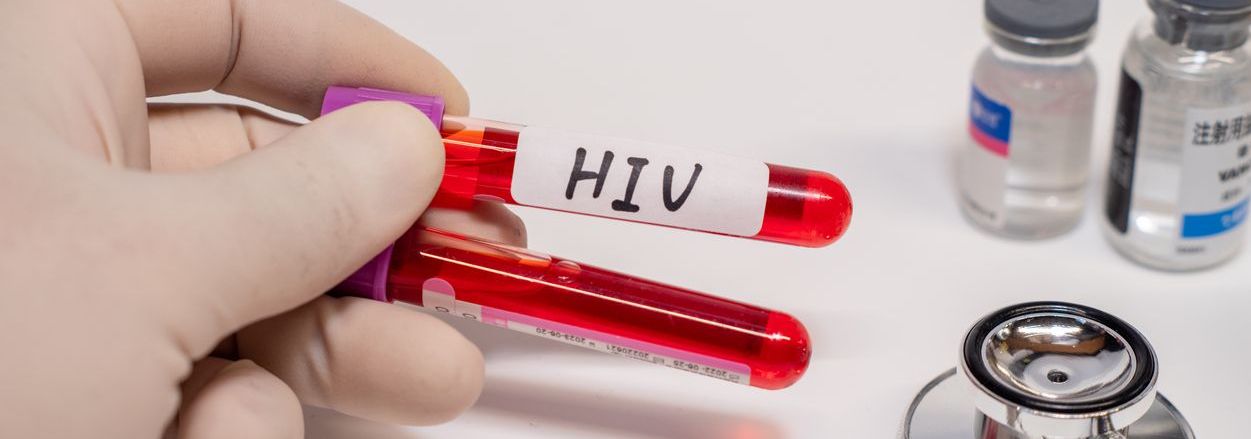 ¿Cómo se transmite el VIH? Guía clara para entender las vías reales de contagio