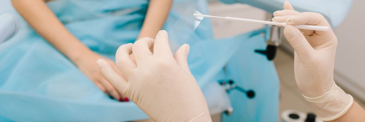 PCR VPH: Cómo se detecta el virus del papiloma humano