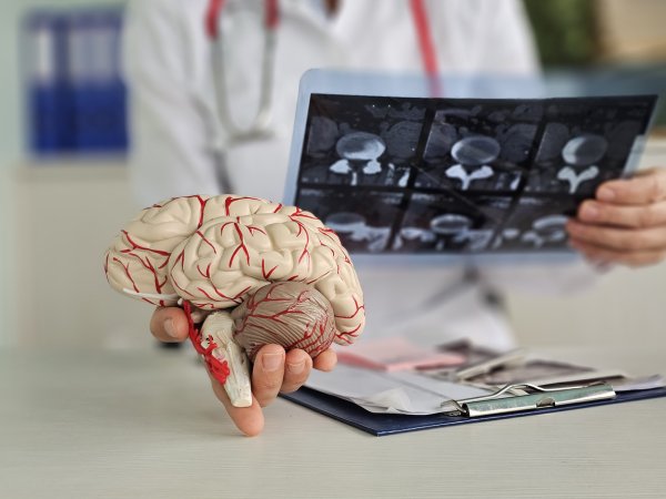 Síntomas de Alzheimer: Señales de alerta temprana y los beneficios de tu Isapre CruzBlanca